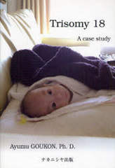 Trisomy18 A case study