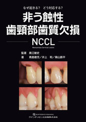 󤦿»NCCL ʤ?ɤб?