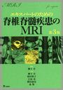 ѡȤΤԿMRI